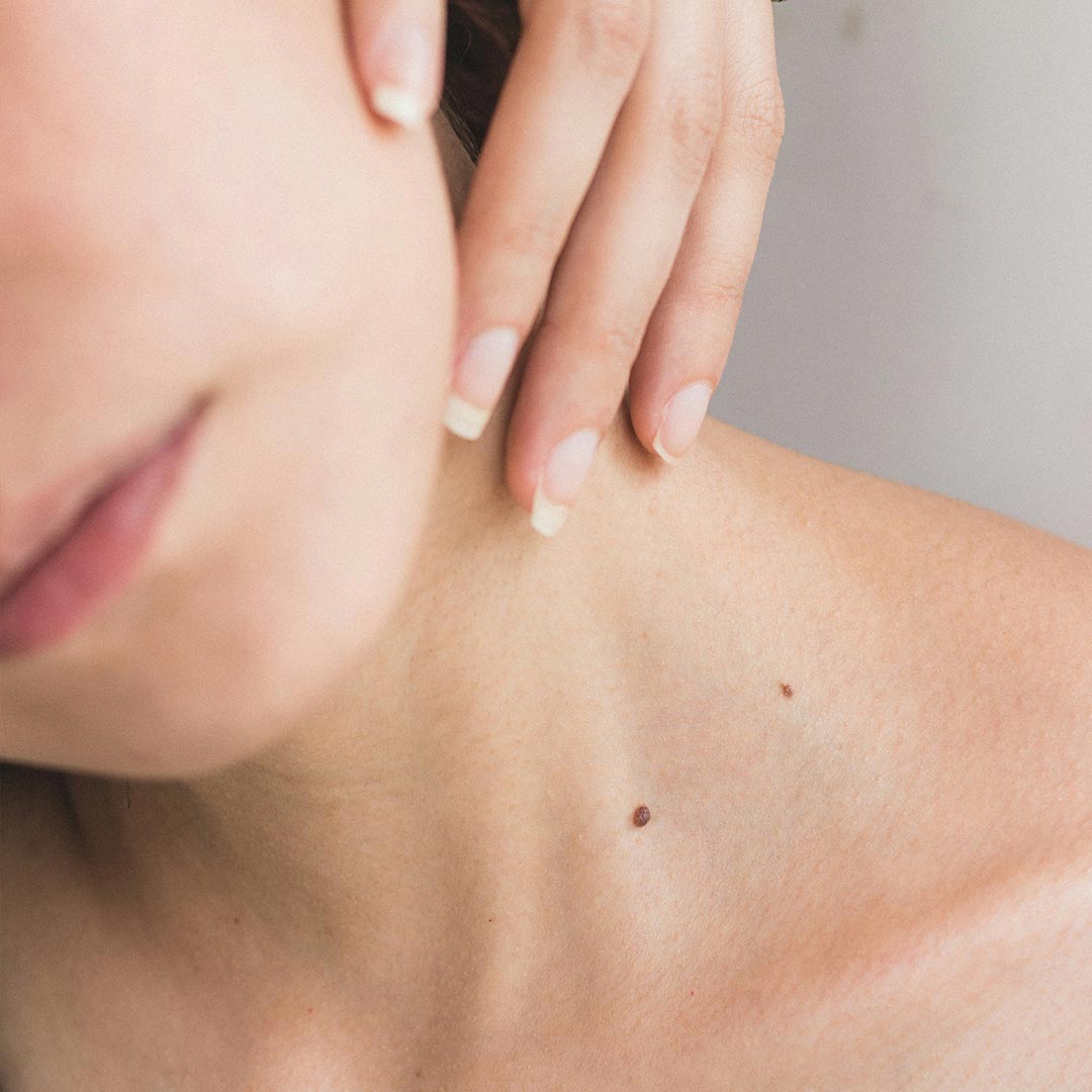Pourquoi faut-il prendre soin de sa peau ?